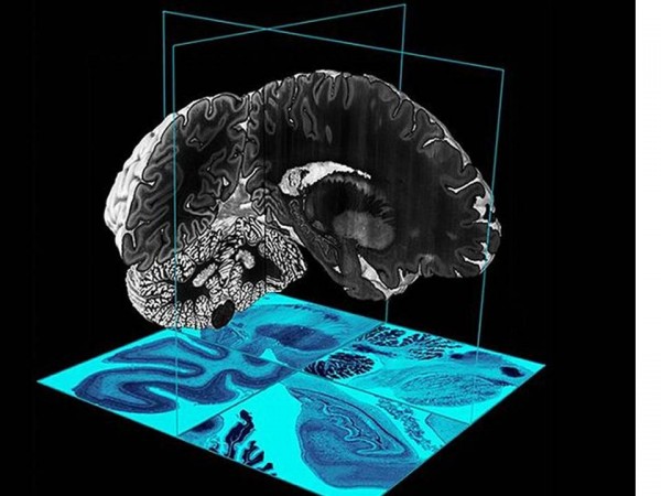 3D